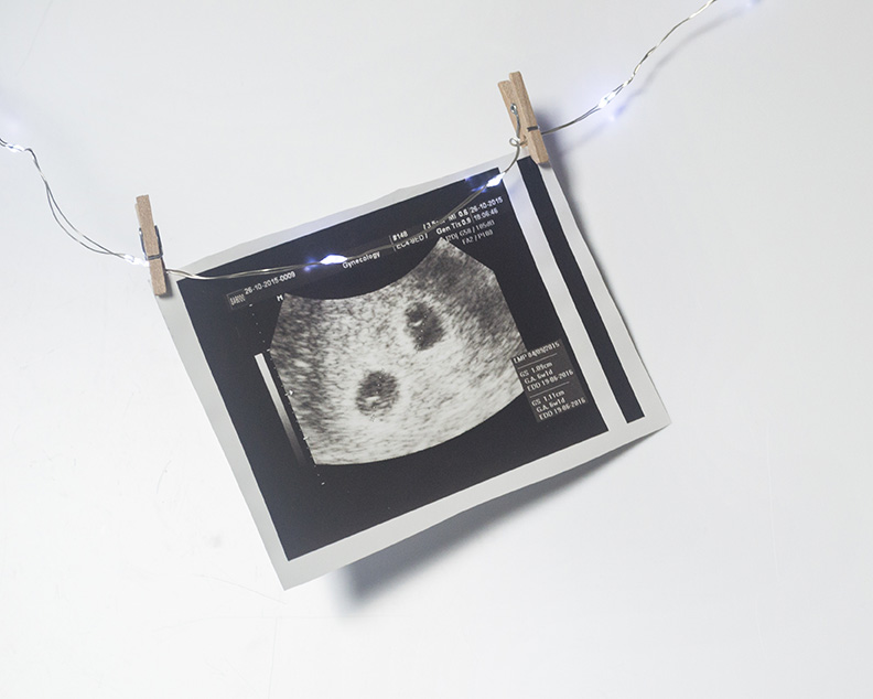 Sonogram for pregnancy support in Bel Air, MD